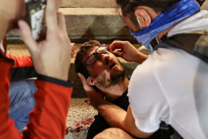 Ošetřování zraněného demonstranta: úterý 7. července v Bělehradu. Foto: Marko Djurica, Reuters