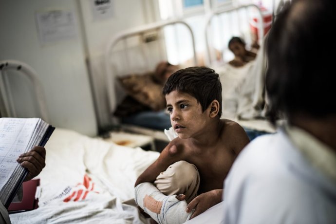Děti, které ošetřují v nemocnici Lékařů bez hranic v afghánském Laškargáhu, trpí podvýživou, sáhly si na minu nebo si je vybrala zbloudilá kulka. Foto: Foto: Kadir van Lohuizen, NOOR, Lékaři bez hranic