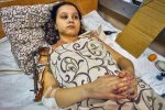 Masha Feschenko (15) was injured on March 13 in her residence in Polohy, Zaprozhskaya Oblast. It was a beautiful day, quiet and sunny, and Masha, her mother, and a girlfriend left the cellar which they have been using as a bomb shelter, and went for a walk outside. Just then, an artillery shell landed 3 meters away and exploded. Masha's mother lay down on both girls to protect them, and she was badly wounded, losing a leg in the blast. Masha's right arm was also shredded by shrapnel, one of her shoulders was broken, and later, her right leg was amputated. The town of Polohy has been under attack since March 2nd.