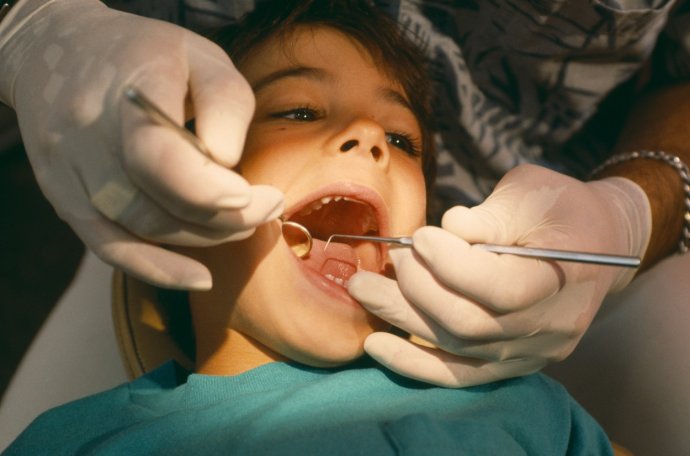 Ošetřování dětí u zubaře je složitější než u dospělých. Ilustrační foto: Profimedia