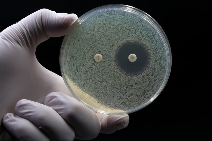 Rezistence mikrobů na antibiotika může patřit k vážným problémům letošního roku. Foto: Adobe Stock