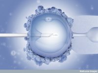 Umělé oplodnění , při němž je do vajíčka vpravena spermie a to se pak vloží do matčiny dělohy, je nyní v Alabamě a potažmo v USA v ohrožení. Podle nového rozhodnutí tamního soudu je totiž embryo dítě, a tak případné ničení nepotřebných embryií může být považováno za zabíjení dětí. Foto: Maurizio De Angelis, Flickr, CC BY-NC-ND 2.0 