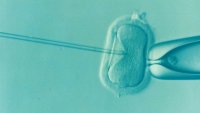 Embryo. In Vitro Fertilization (IVF): Step by Step - Northern California Fertility Medical Center